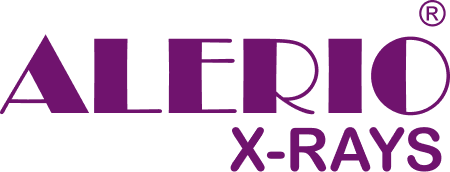 Alerio-X-Ray